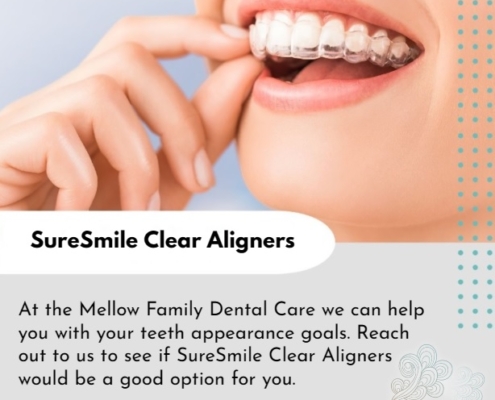 SureSmile Clear Aligners