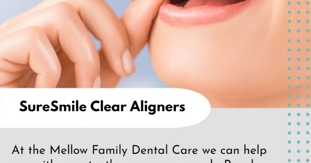 SureSmile Clear Aligners